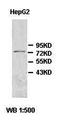 ADAM Metallopeptidase Domain 20 antibody, orb77013, Biorbyt, Western Blot image 