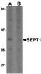 Septin 1 antibody, TA319634, Origene, Western Blot image 