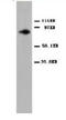 Protein Kinase C antibody, AP23369PU-N, Origene, Western Blot image 
