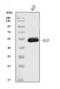 Homogentisate 1,2-Dioxygenase antibody, M01909-1, Boster Biological Technology, Western Blot image 