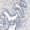 Histone-lysine N-methyltransferase MLL4 antibody, HPA021324, Atlas Antibodies, Immunohistochemistry frozen image 