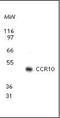 C-C chemokine receptor type 10 antibody, orb87909, Biorbyt, Western Blot image 