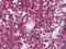 CD247 Molecule antibody, M02421-3, Boster Biological Technology, Immunohistochemistry paraffin image 