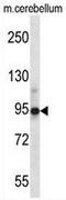 Chordin antibody, AP50905PU-N, Origene, Western Blot image 