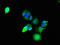 ADAM Metallopeptidase With Thrombospondin Type 1 Motif 9 antibody, orb52094, Biorbyt, Immunocytochemistry image 