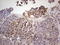 Ret Proto-Oncogene antibody, LS-C339708, Lifespan Biosciences, Immunohistochemistry paraffin image 