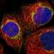 Mitochondrial Fission Regulator 1 antibody, NBP1-84480, Novus Biologicals, Immunocytochemistry image 