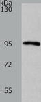 Histone H2A deubiquitinase MYSM1 antibody, TA323310, Origene, Western Blot image 