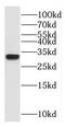 Proteasome Subunit Alpha 1 antibody, FNab06861, FineTest, Western Blot image 