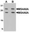 Membrane Spanning 4-Domains A6A antibody, PA5-72732, Invitrogen Antibodies, Western Blot image 