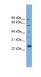 B-cell CLL/lymphoma 7 protein family member A antibody, orb330926, Biorbyt, Western Blot image 