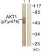 Akt antibody, PA5-38351, Invitrogen Antibodies, Western Blot image 