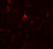 Phosphatidylinositol Binding Clathrin Assembly Protein antibody, 5553, ProSci, Immunofluorescence image 