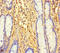 LTV1 Ribosome Biogenesis Factor antibody, LS-C397840, Lifespan Biosciences, Immunohistochemistry paraffin image 