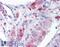 Metastasis Associated 1 antibody, 45-094, ProSci, Western Blot image 