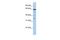 Polypeptide N-Acetylgalactosaminyltransferase 16 antibody, PA5-43376, Invitrogen Antibodies, Western Blot image 