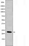 B-cell CLL/lymphoma 7 protein family member A antibody, orb227249, Biorbyt, Western Blot image 