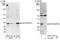 DNA Fragmentation Factor Subunit Alpha antibody, A301-421A, Bethyl Labs, Western Blot image 