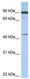 26S proteasome non-ATPase regulatory subunit 6 antibody, TA330284, Origene, Western Blot image 