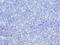 Minichromosome Maintenance Complex Component 3 antibody, LS-C376104, Lifespan Biosciences, Immunohistochemistry paraffin image 