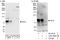 Mtg8 antibody, A303-509A, Bethyl Labs, Western Blot image 