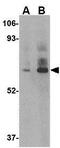 Probable ATP-dependent RNA helicase DHX58 antibody, GTX16994, GeneTex, Western Blot image 