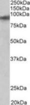 Zinc finger protein 652 antibody, NBP1-97753, Novus Biologicals, Western Blot image 