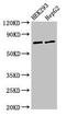 GTP Binding Protein 4 antibody, LS-C672536, Lifespan Biosciences, Western Blot image 
