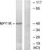 Neuropeptide Y Receptor Y1 antibody, TA314281, Origene, Western Blot image 