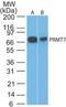 Protein Arginine Methyltransferase 7 antibody, TA336349, Origene, Western Blot image 