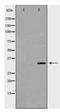 Cyclin D2 antibody, TA348014, Origene, Western Blot image 
