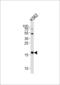 N-Acetyltransferase 14 (Putative) antibody, LS-C164754, Lifespan Biosciences, Western Blot image 