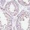 C22 antibody, NBP2-38019, Novus Biologicals, Immunohistochemistry frozen image 