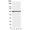 Methyl-CpG Binding Domain 4, DNA Glycosylase antibody, R31152, NSJ Bioreagents, Western Blot image 
