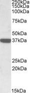 Calponin 3 antibody, LS-B10322, Lifespan Biosciences, Western Blot image 
