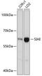 Sialic Acid Acetylesterase antibody, 14-855, ProSci, Western Blot image 