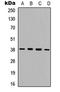 Protein Kinase AMP-Activated Non-Catalytic Subunit Beta 1 antibody, LS-C358838, Lifespan Biosciences, Western Blot image 
