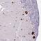 Fibrosin Like 1 antibody, NBP2-14695, Novus Biologicals, Immunohistochemistry paraffin image 