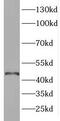 ELOVL Fatty Acid Elongase 6 antibody, FNab02748, FineTest, Western Blot image 
