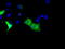 Bruton Tyrosine Kinase antibody, LS-C115142, Lifespan Biosciences, Immunofluorescence image 