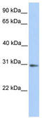 Abhydrolase Domain Containing 13 antibody, TA339635, Origene, Western Blot image 