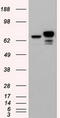 Catenin Beta 1 antibody, TA500048S, Origene, Western Blot image 