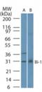 Transmembrane BAX Inhibitor Motif Containing 6 antibody, NBP2-24949, Novus Biologicals, Western Blot image 