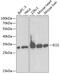 Enoyl-CoA Delta Isomerase 1 antibody, GTX53991, GeneTex, Western Blot image 