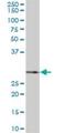Small Nuclear Ribonucleoprotein Polypeptide A' antibody, H00006627-B01P, Novus Biologicals, Western Blot image 