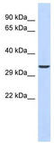 Ventral Anterior Homeobox 1 antibody, TA341826, Origene, Western Blot image 