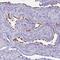 Bardet-Biedl Syndrome 10 antibody, NBP2-32399, Novus Biologicals, Immunohistochemistry paraffin image 