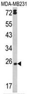 Lymphotoxin Alpha antibody, AP17540PU-N, Origene, Western Blot image 