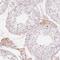 Complement Factor H Related 2 antibody, HPA049813, Atlas Antibodies, Immunohistochemistry frozen image 