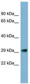PRKR Interacting Protein 1 antibody, TA344194, Origene, Western Blot image 